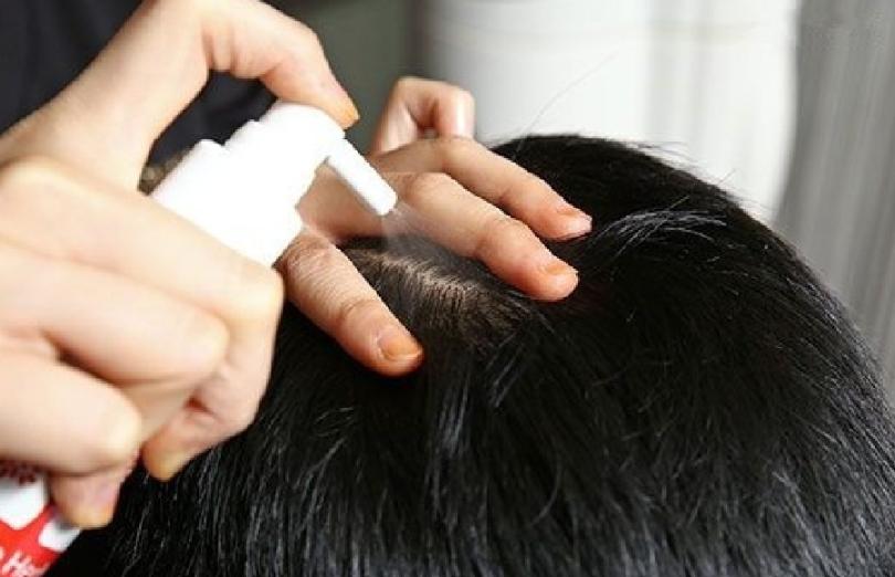 白发多也不要频繁染发，伤发又上头皮，这四个小妙招解决白发困扰三周染一次伤发又伤头皮四种解决白发的小技巧