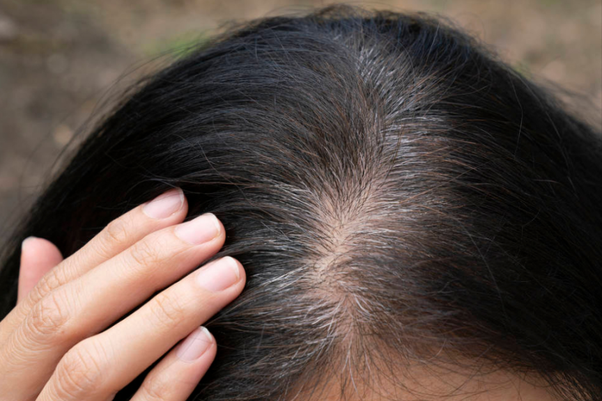 白发多也不要频繁染发，伤发又上头皮，这四个小妙招解决白发困扰三周染一次伤发又伤头皮四种解决白发的小技巧